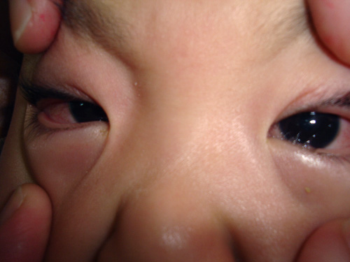 仁爱医疗财团法人 - 开学季 腺病毒也来凑热闹