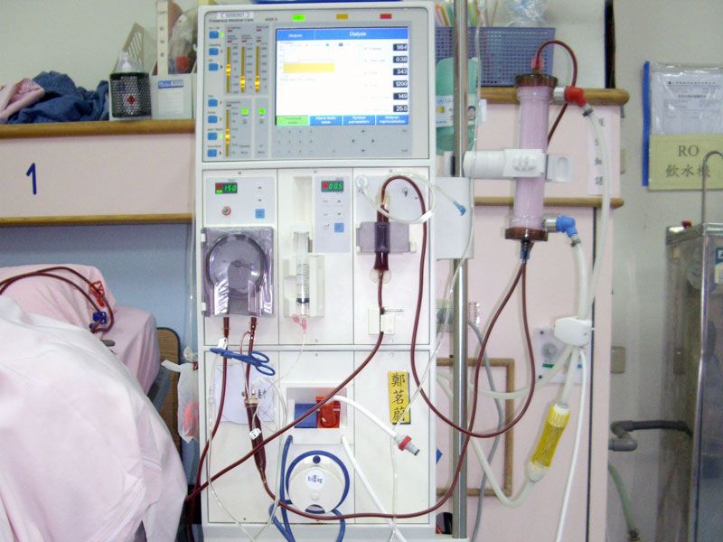 尿毒症透析医保报销吗 肾透析异地医保