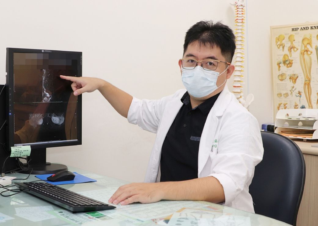 張育銘醫師指出，病人腰椎第一節硬膜內腫瘤。