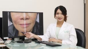 新聞圖片:中年女臉部皺紋顯疲態  皮膚科醫師教你破解歲月痕跡