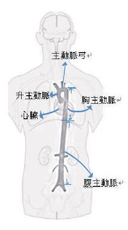 仁愛醫療財團法人 致命的 腹主動脈瘤破裂