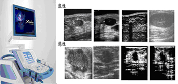 全數位化超音波掃瞄儀，高影像解析度