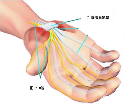 仁愛醫療財團法人 腕隧道症候群